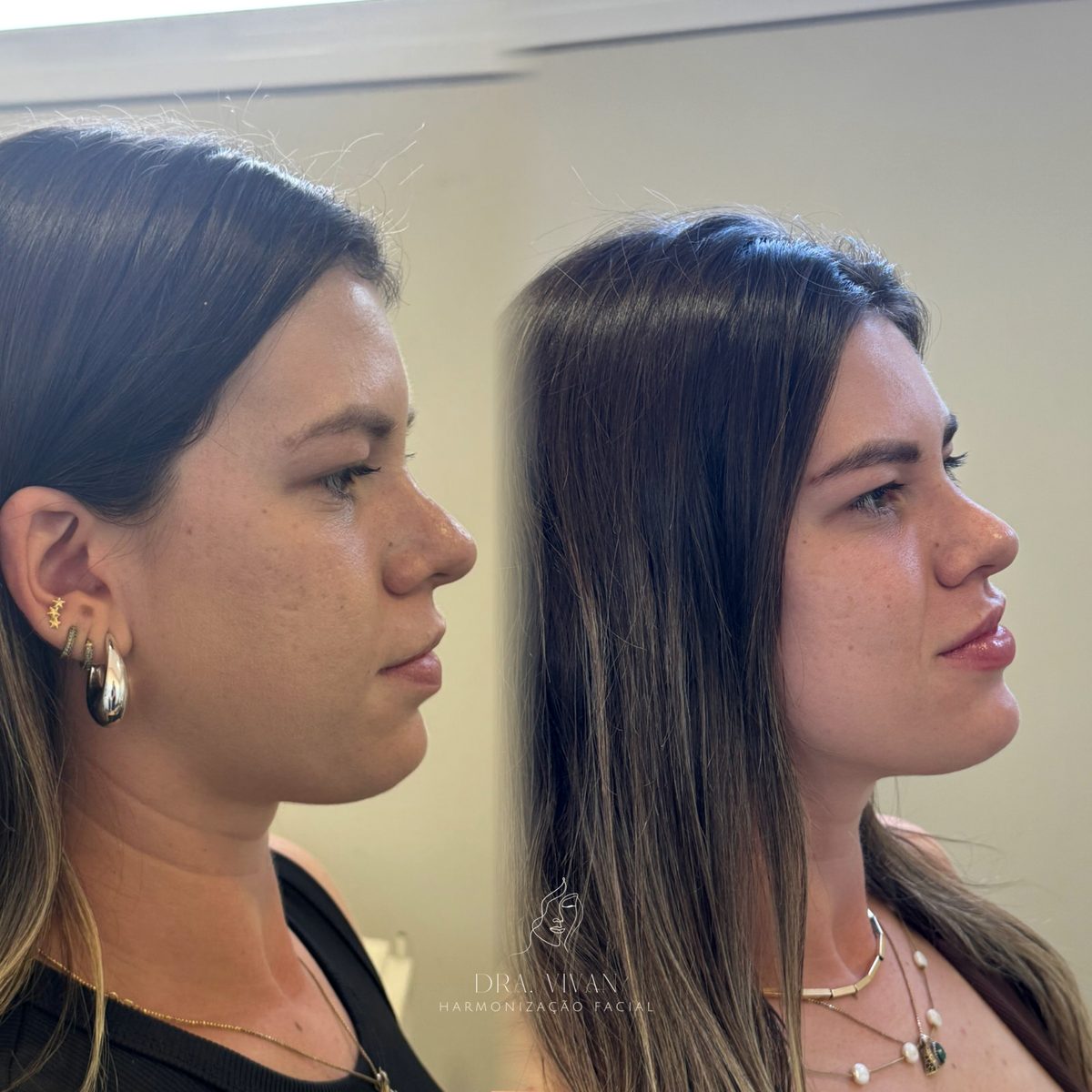 Caso 07 — paciente da Dra. Vivian Milozo